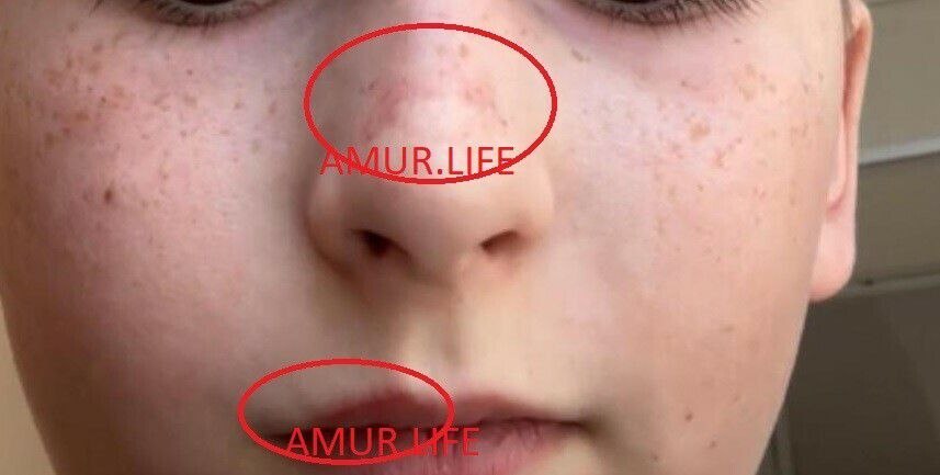 Сын кричал и плакал: «Мамочка, мне больно!»: в благовещенском кафе ребенку в лицо распылили перцовый баллончик