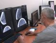 В Амурском онкодиспансере применяют органосберегающие технологии при лечении злокачественных новообразований молочной железы