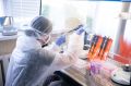 Ученые создали комплексы серебра эффективнее антибиотиков