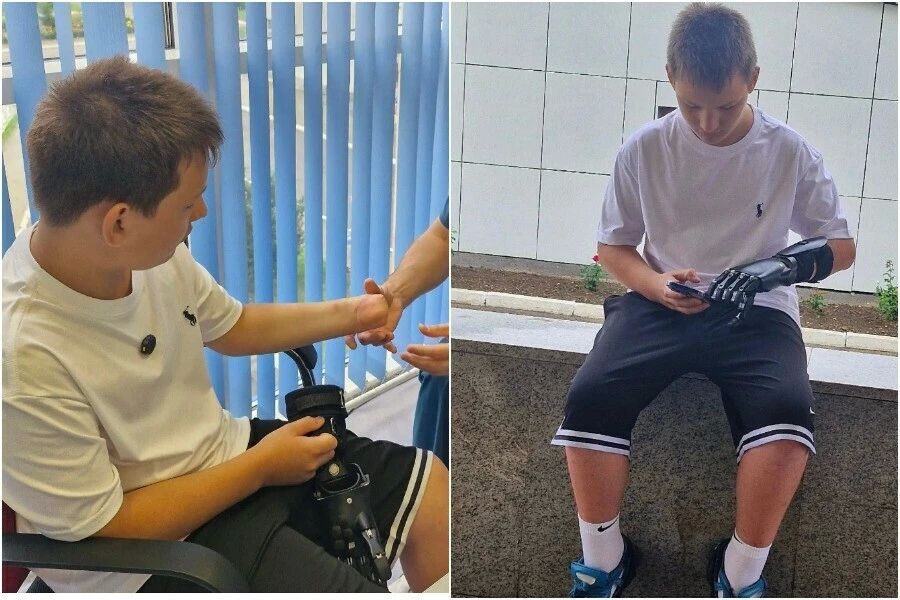 «С ужасом вспоминаю тот день»: как возвращается к привычной жизни 12-летний благовещенец, потерявший часть руки из-за взрыва петарды
