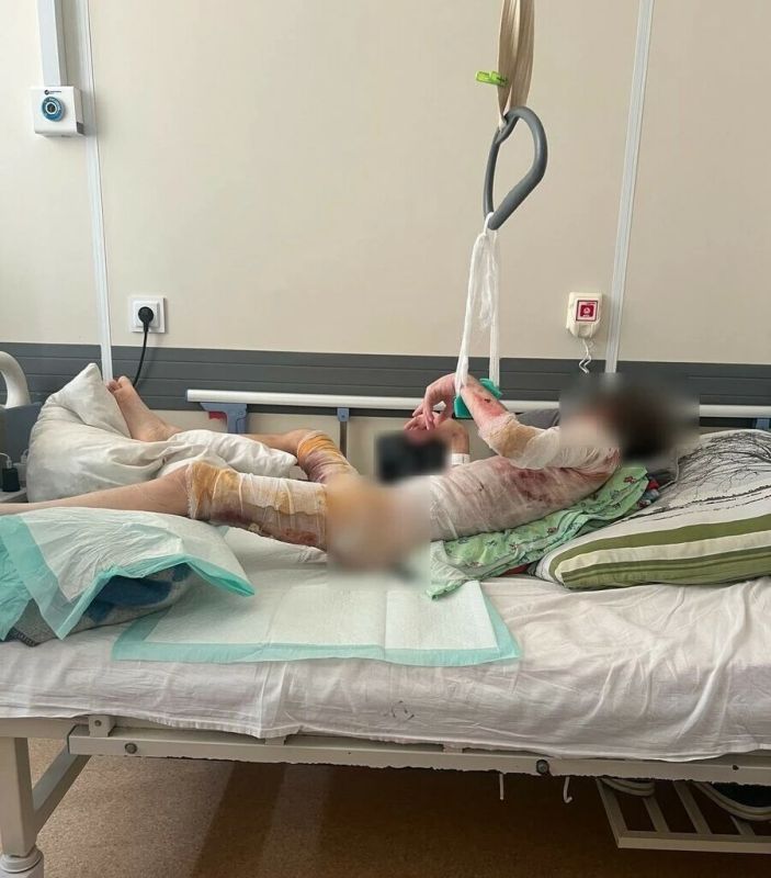 Все участники инцидента, в котором благовещенский школьнике получил серьезные ожоги, установлены